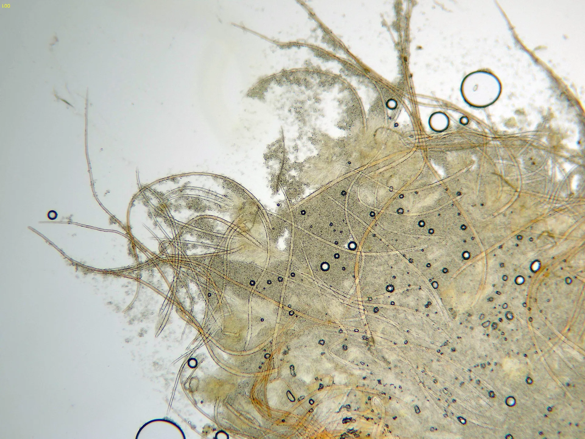 Microscopía de Scolecofusarium ciliatum - 11 - x 100-001